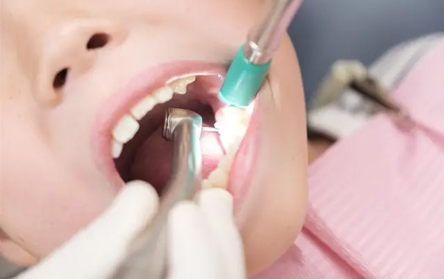 歯と歯の間のエナメル質を少し削ってスペースを作ることです。